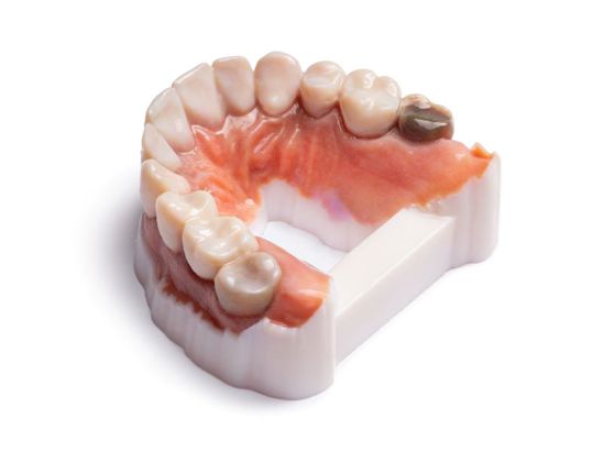 Dentures 3D printed with Statasys VeroVivid material