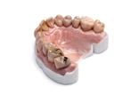 Dentures 3D printed with Statasys VeroVivid material