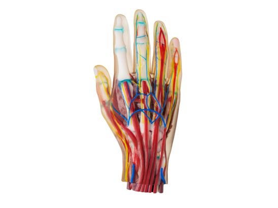 3D printed medical model hand by Stratasys Polyjet technology